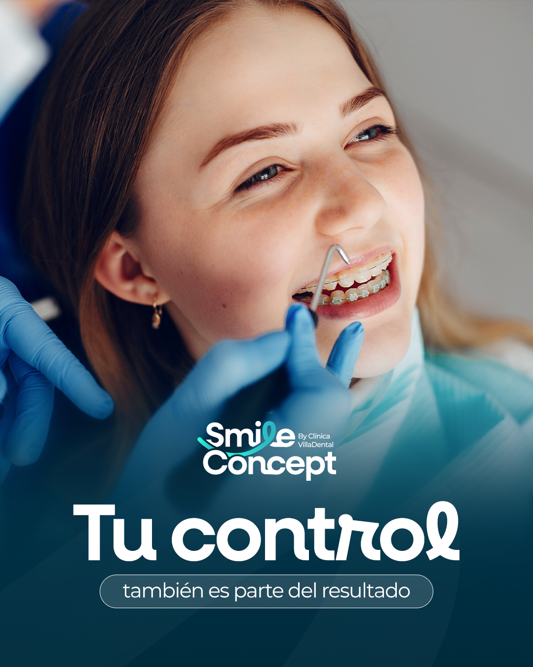 Ortodoncia brackets Smile Concept Soyapango